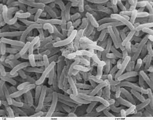 Elektron-mikroskopiese beeld van <i>Vibrio cholerae</i>, 'n bakterieë wat die verteringstelsel aanval.